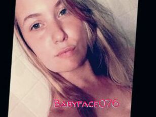 Babyface076