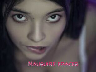 Nauguire_braces