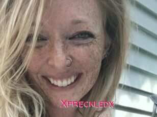 Xfreckledx